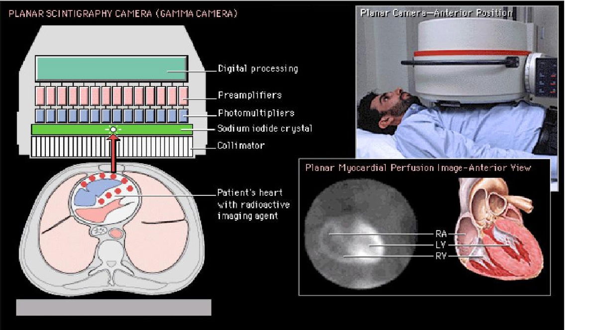 Myocardial Perfusion Imaging الدكتور ابراهيم عبد الرزاق البطيحي