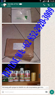 Salep Kutil Untuk Mengobati Kutil Kelamin 1 Hari Rontok ...